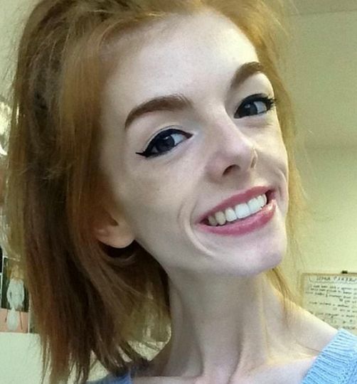 This woman only ate one piece of bread a day for 5 years - Avokaddo.com